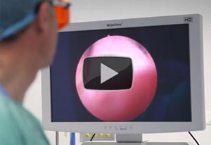 video cirugia prostata